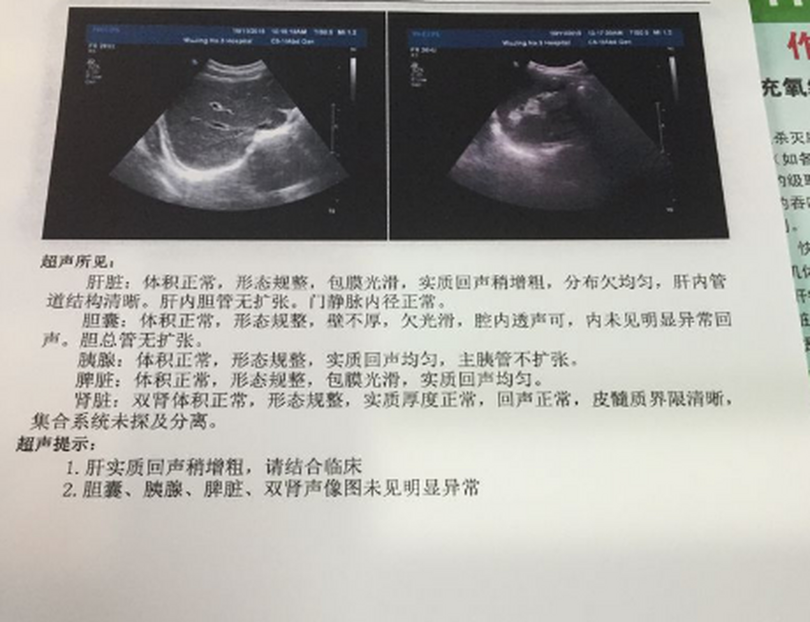 肝部彩超图片