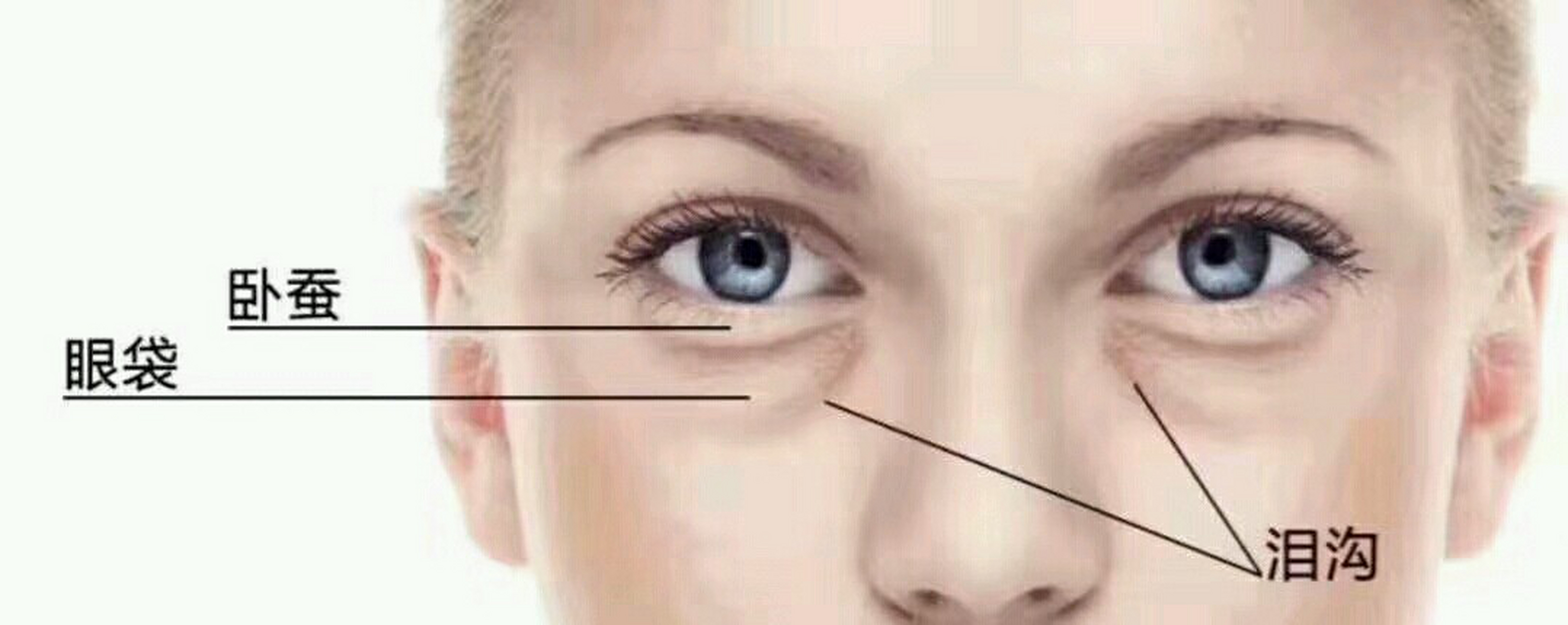 眼袋,卧蚕,泪沟你还在傻傻分不清?