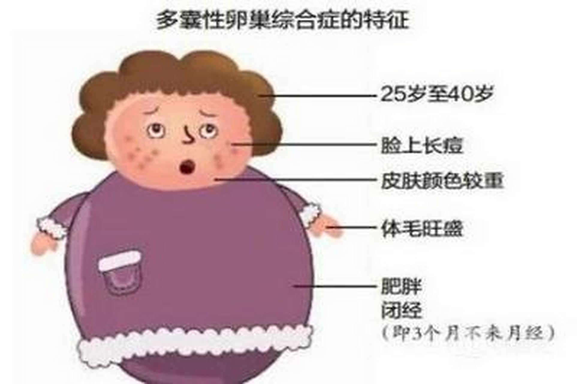 单边卵巢多囊综合征_单侧卵巢多囊能自愈吗