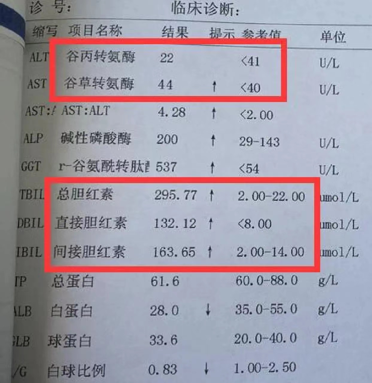 肝病患者转氨酶i正常也别大意,要警惕酶胆分离!