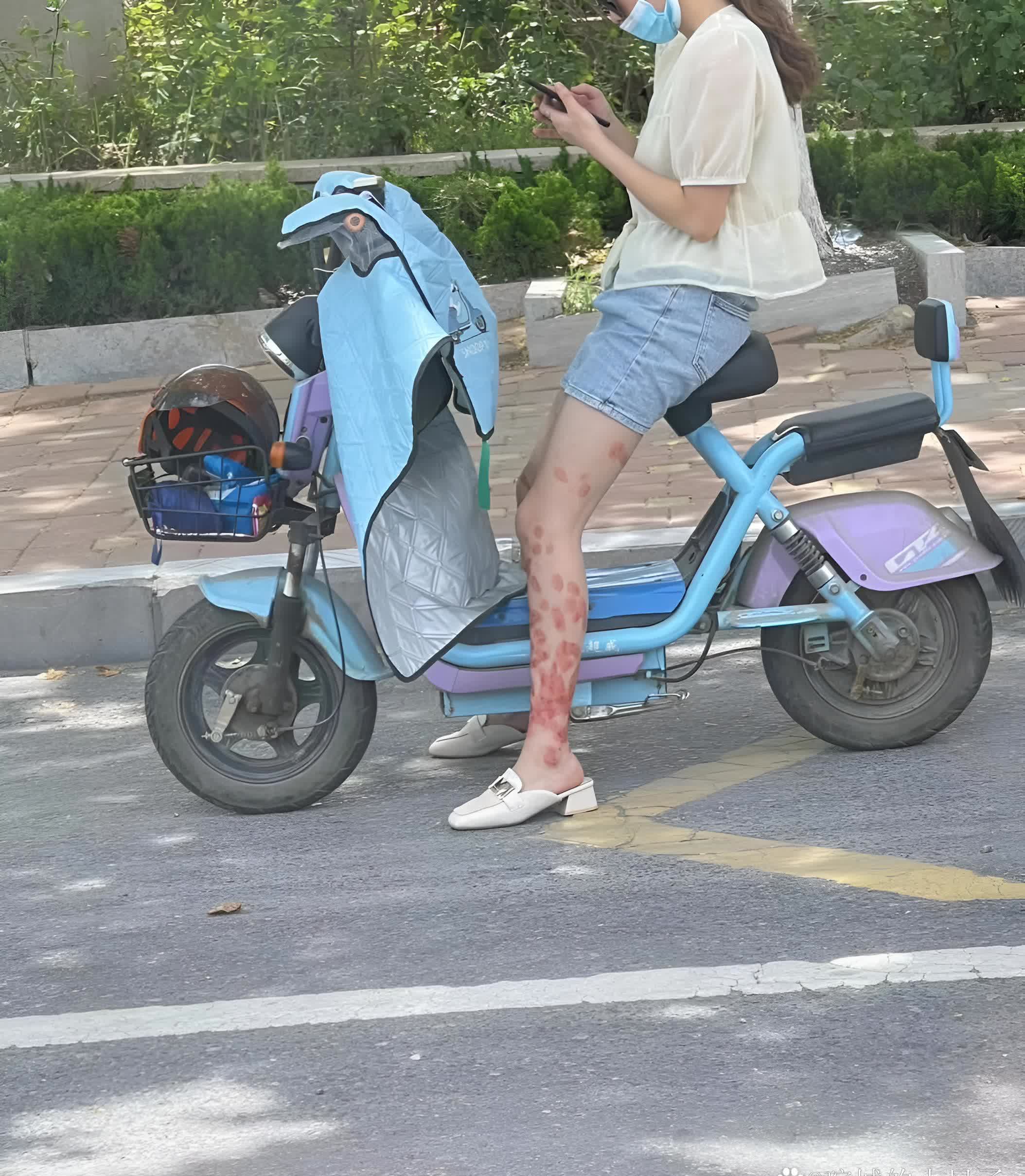 这位小姐姐的腿怎么了? 太可怕了