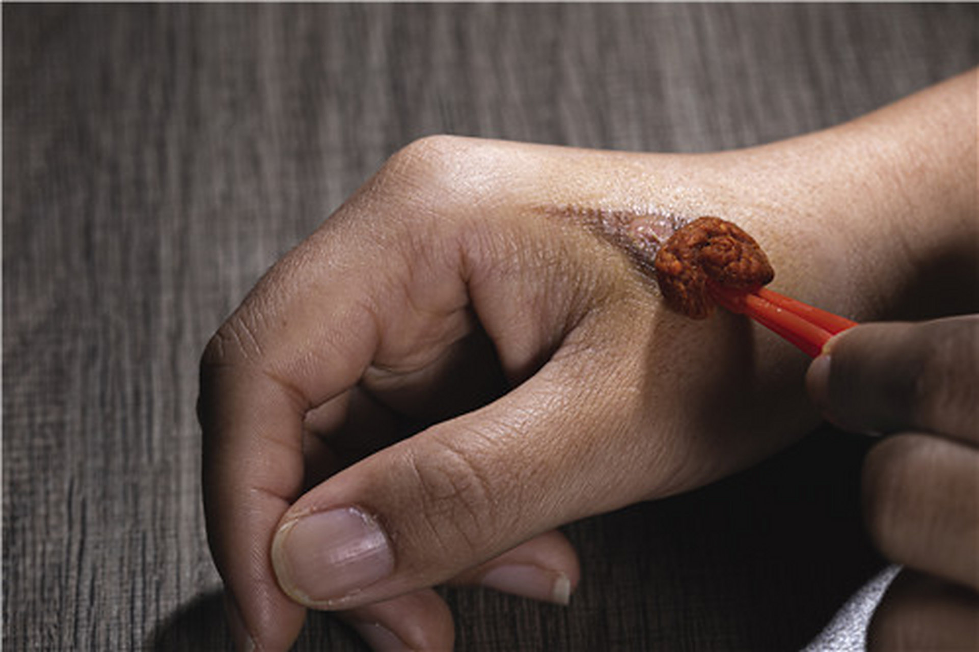 目前,碘伏已逐渐取代红药水,紫药水,酒精和碘酒.