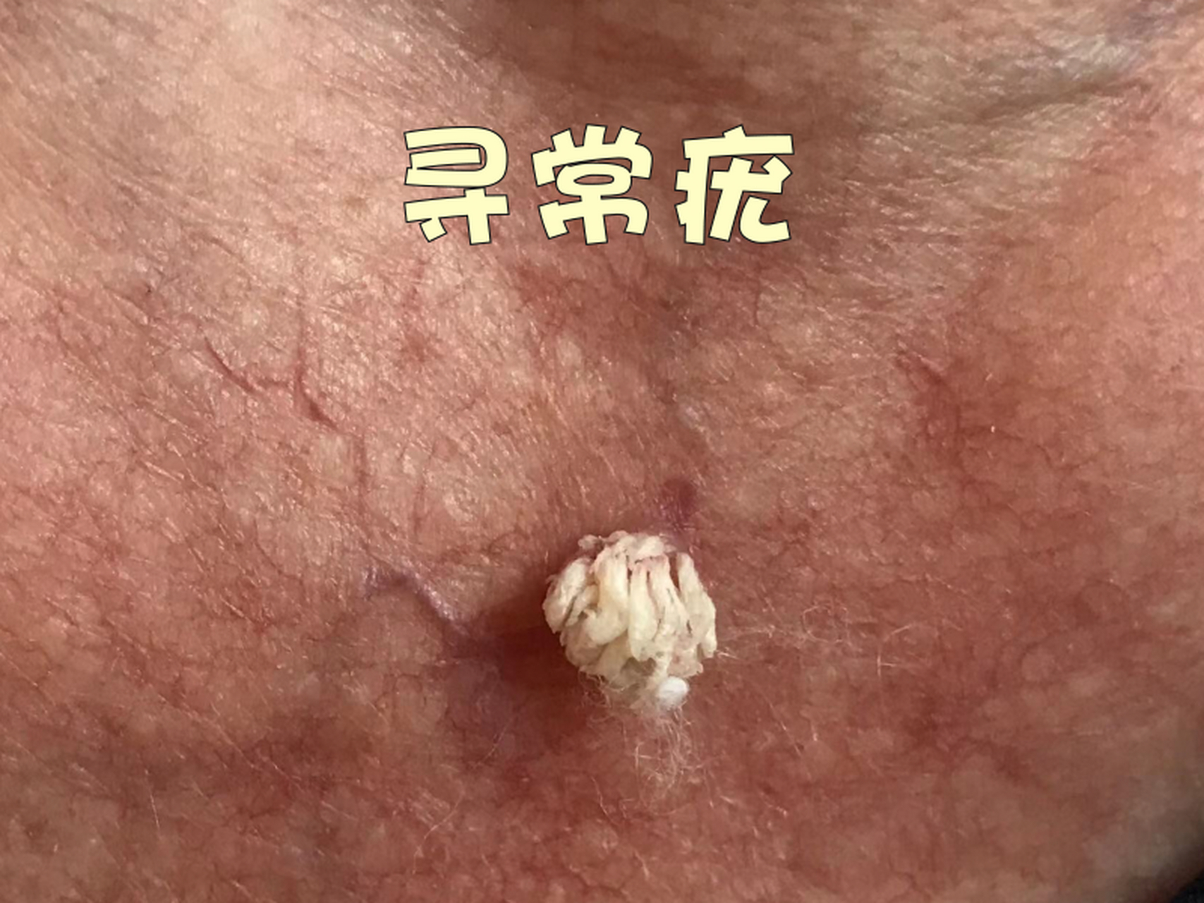 这个话题,大家可能有点过度担忧了, 最近在临床上,总有病人指着脸上