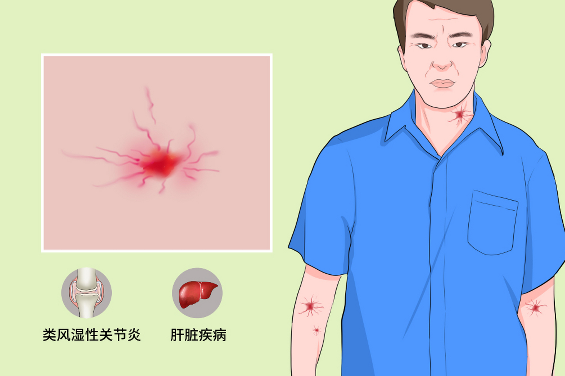 大鱼际红点图片