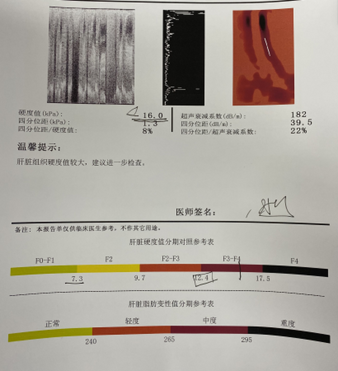 3 这个时候大家放心,肝脏并没有问题,肝脏并没有问题,肝脏还没有纤维