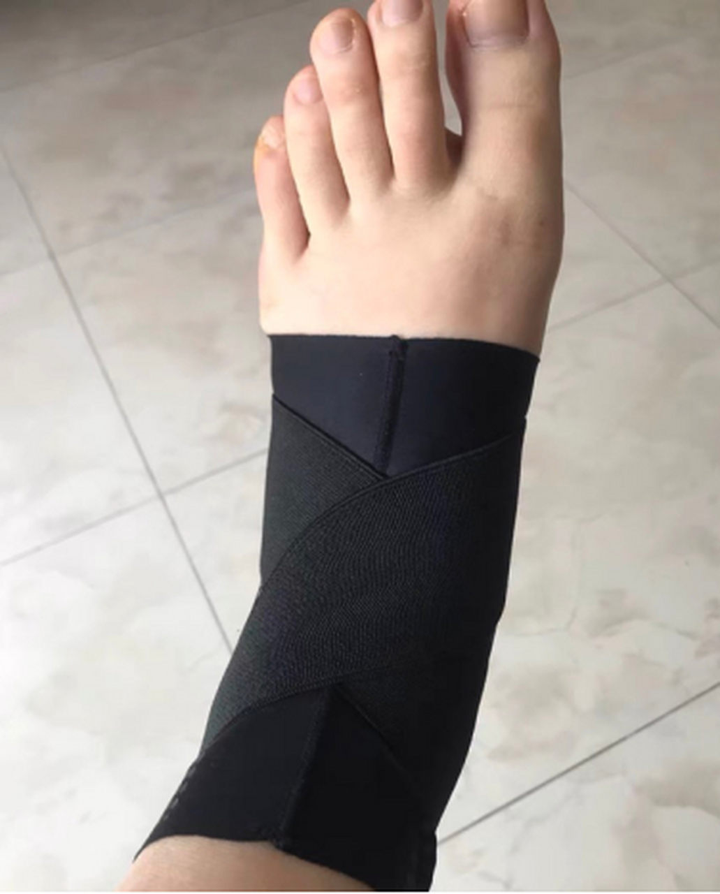 以为扭伤,结果脚踝韧带拉伤[流泪] 2 #韧带拉伤# #疾病治疗经验