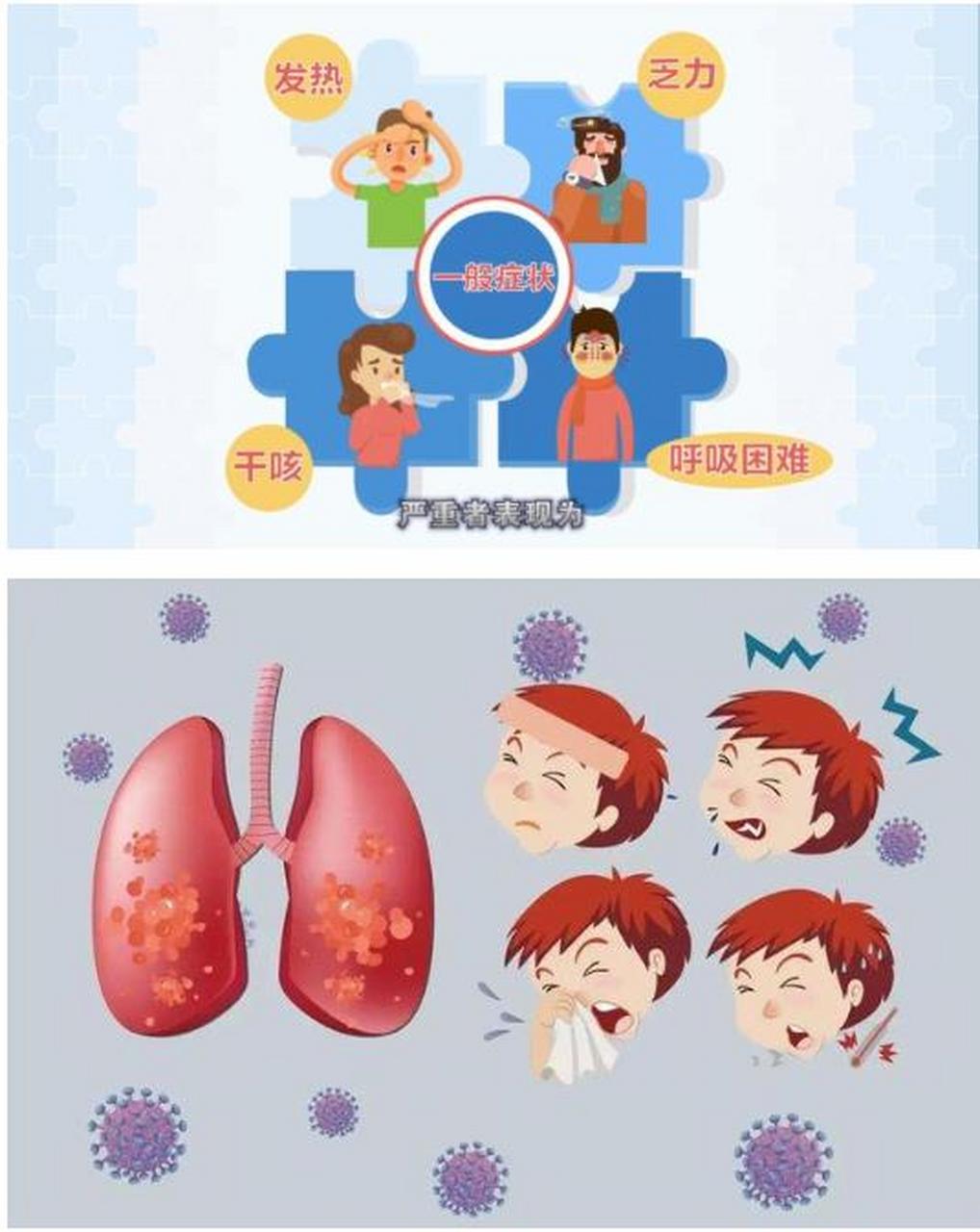细菌性肺炎是最常见的肺炎. 1.肺炎的主要表现 (1)主要症状.