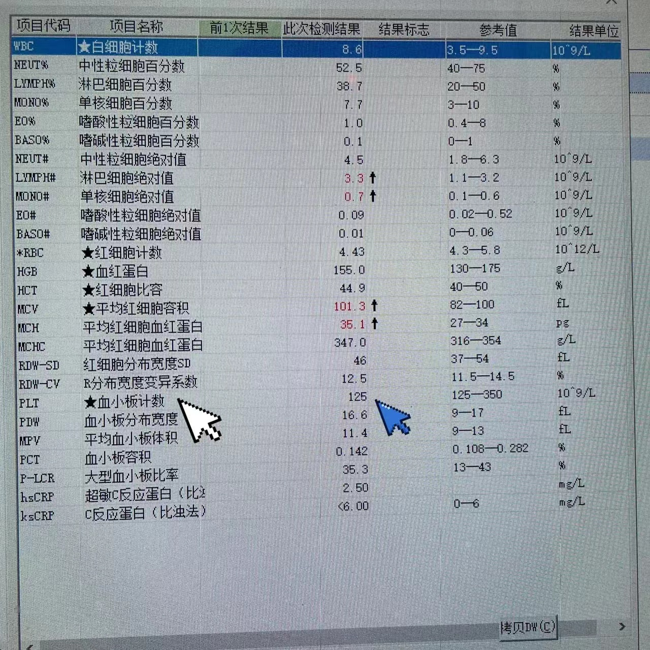 这是一位肝功能异常者的血常规报告单.