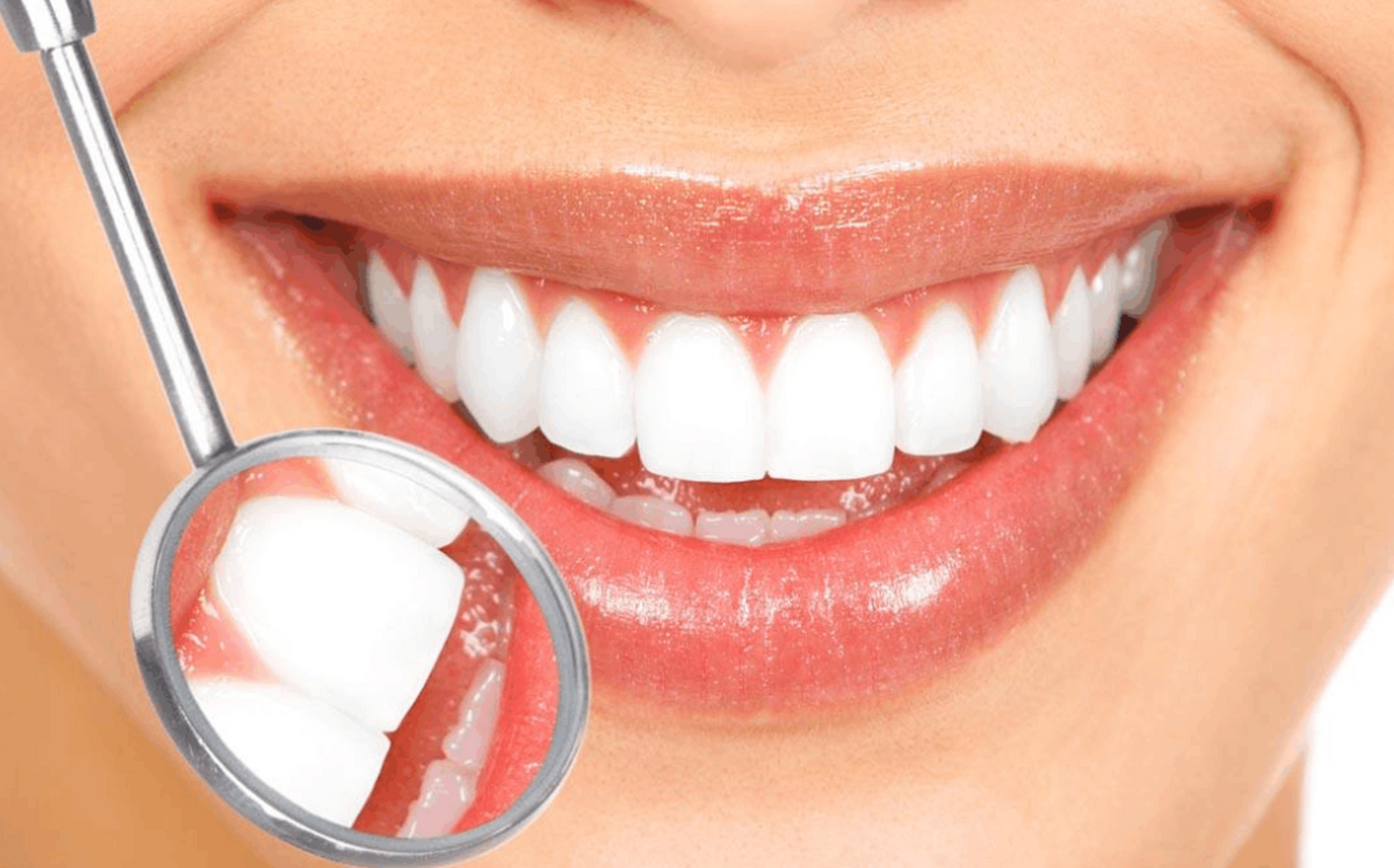 临床常用的美白牙齿方式包括冷光美白,瓷贴面,牙体内漂白,效果都很不