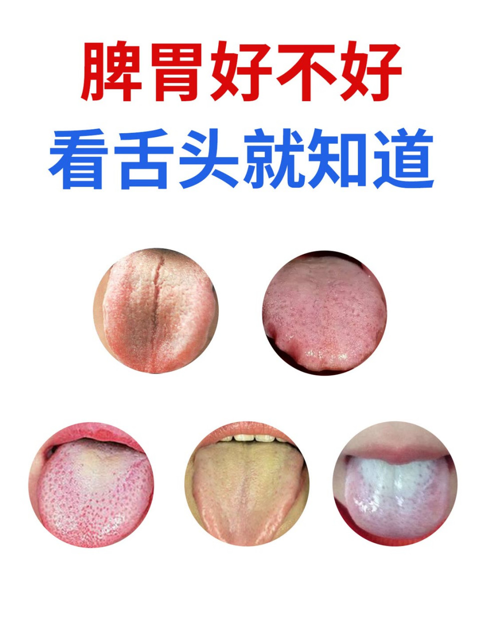 脾胃好不好,看舌头就知道#脾胃# #胃病# #胃炎# #脾胃虚弱