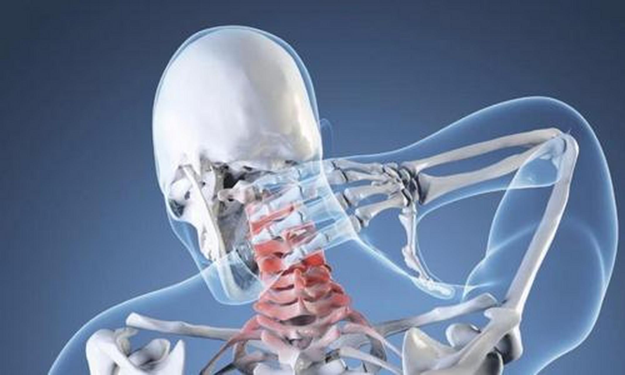 颈型颈椎病  颈项强直,疼痛,可有整个肩背疼痛发僵,不能作点头,仰头