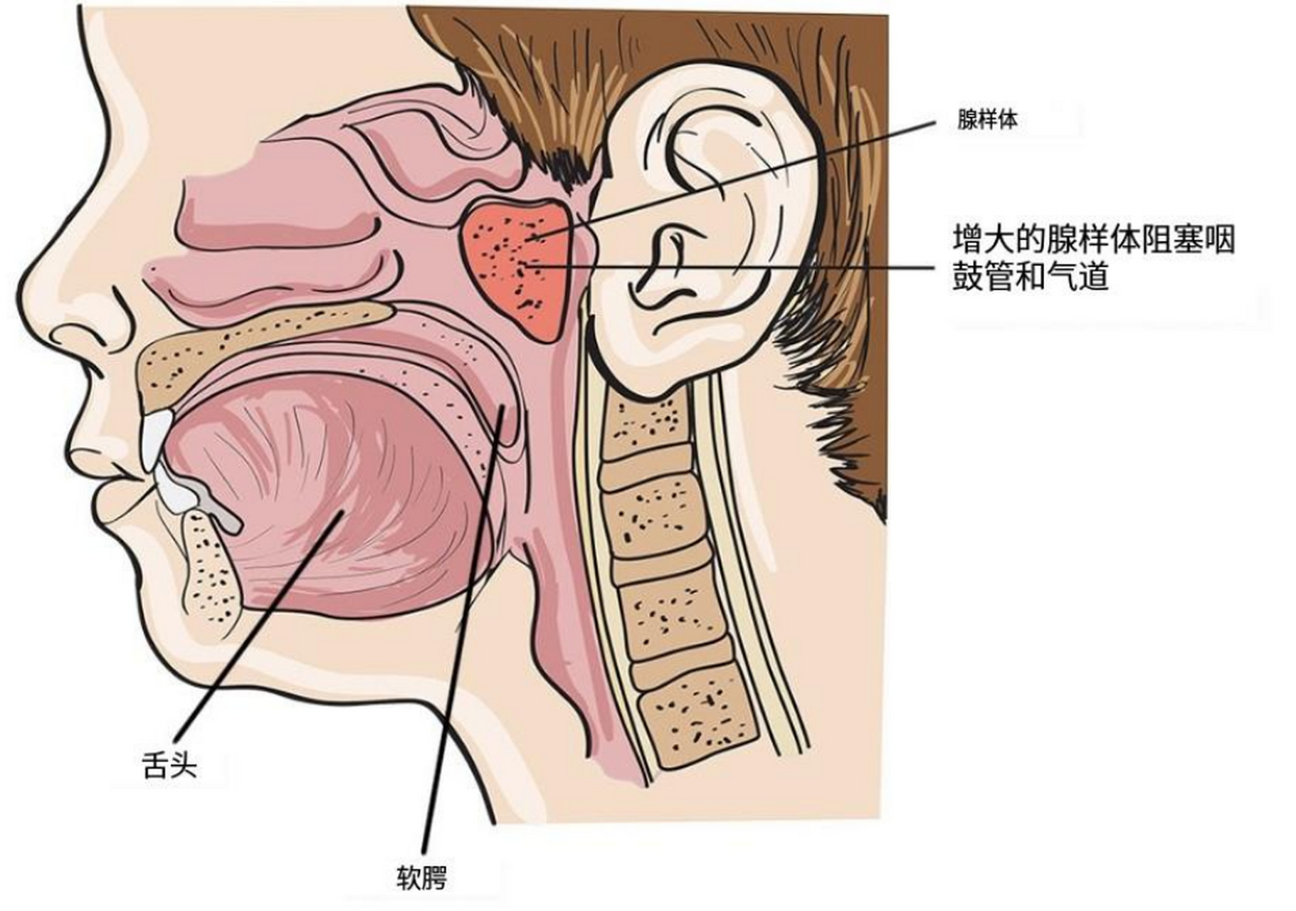 腺样体作用图片