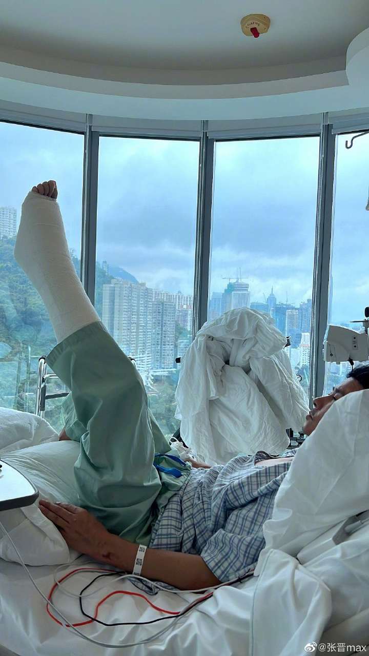 张晋拍戏负伤,单脚打石膏被吊起,网友:娘娘心疼了
