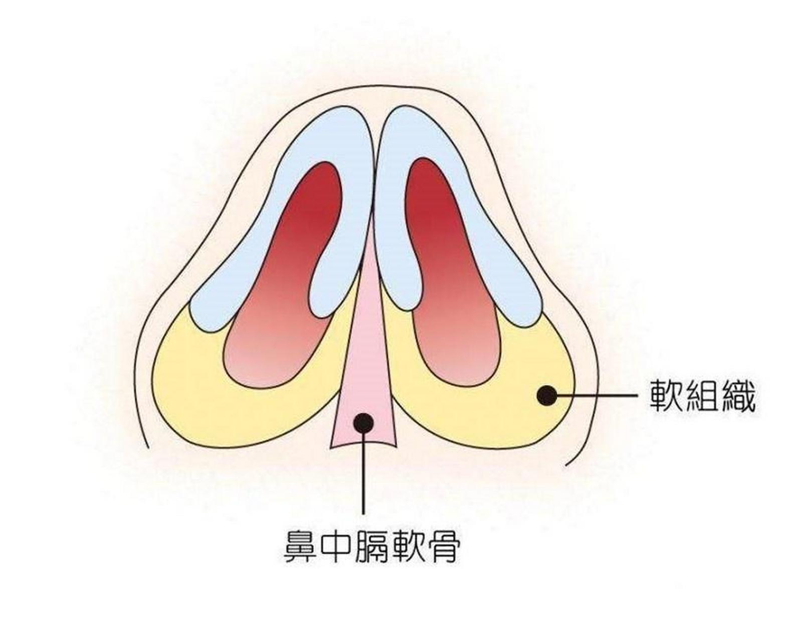 千万别取鼻中隔图片