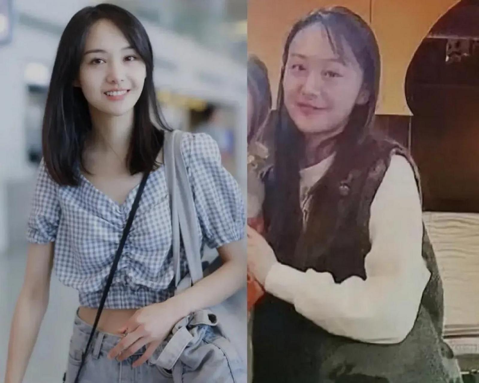 郑爽,老成这样了 清纯的少女,变成了老阿姨 脱发,发福 脸上愁容满面