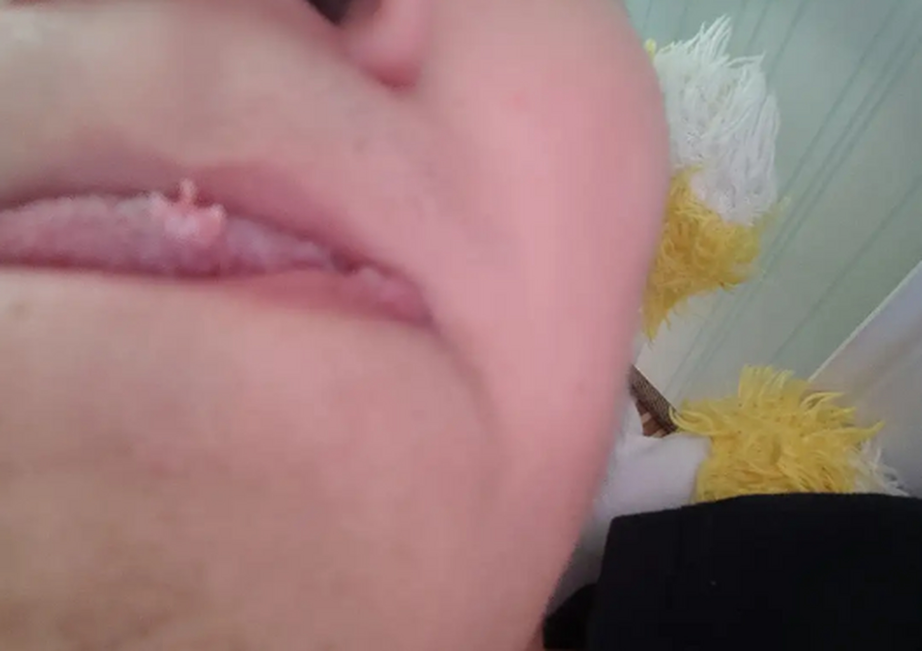 这是我从舌头上切下来的,这是什么啊,不会是癌吧,我没有舔过什么不