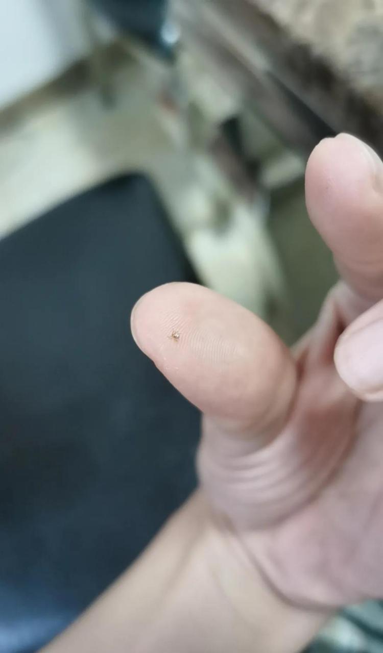 今天发现脚脖子上有个黑点,我就给它扣下来了, 然后发现这个虫子合耨