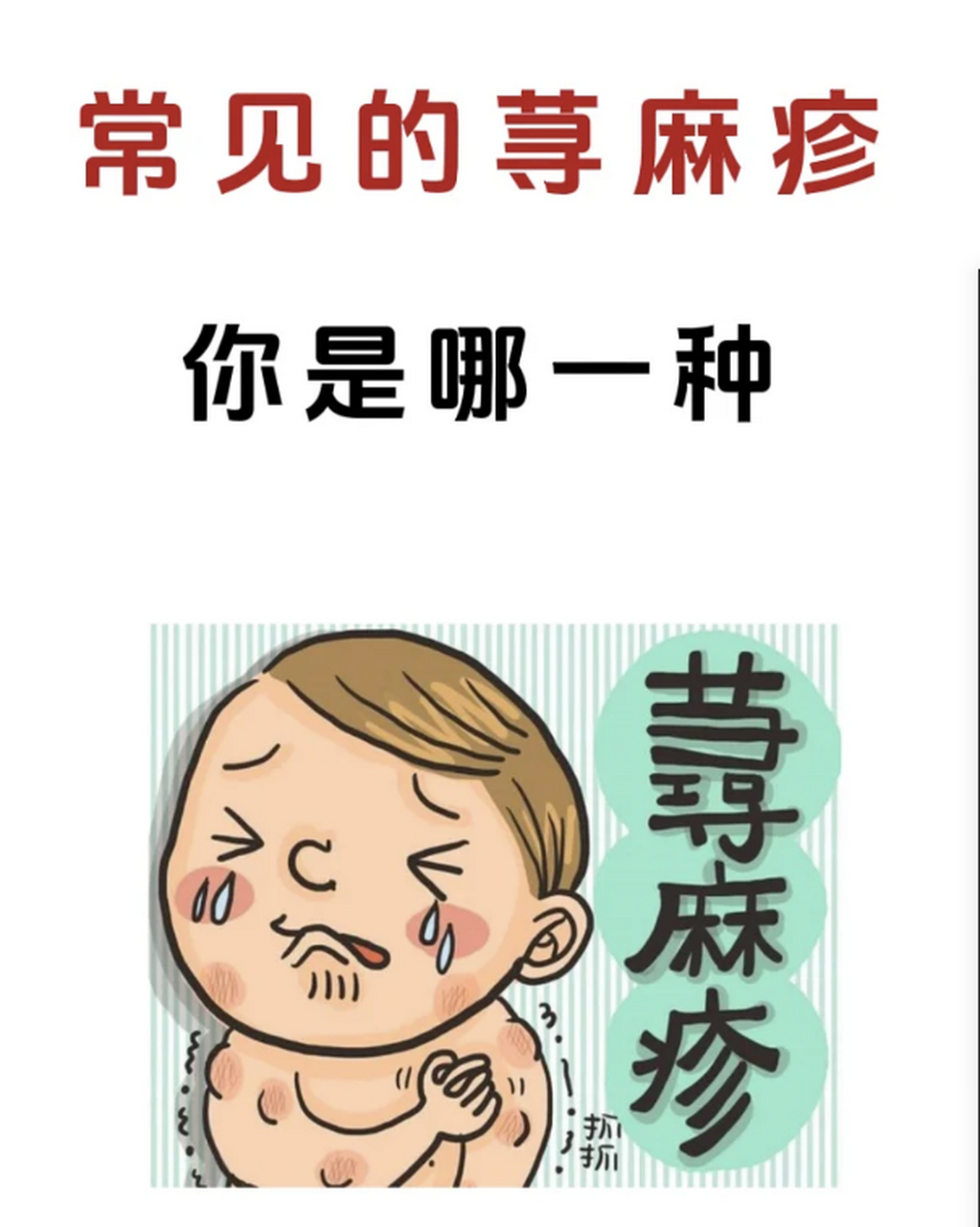 第一种,胆碱能性荨麻疹,这种荨麻疹一般会在运动后或遇到热源时