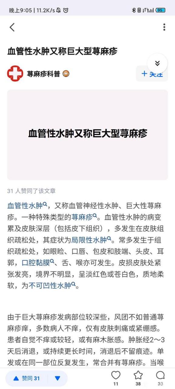 记录我的胆碱能性荨麻疹发展和现状 一 #胆碱能性荨麻疹# #疾病治疗