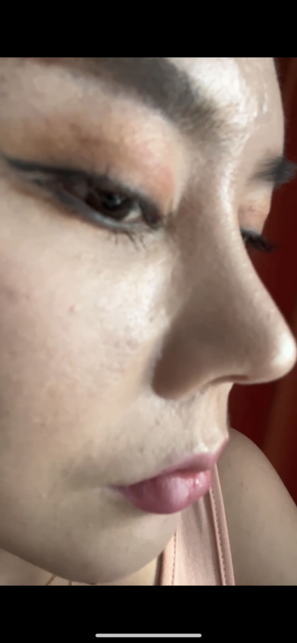 上海李国珍做鼻子做的实在太糟糕,实在是没法看  现在不都是流行鼻子