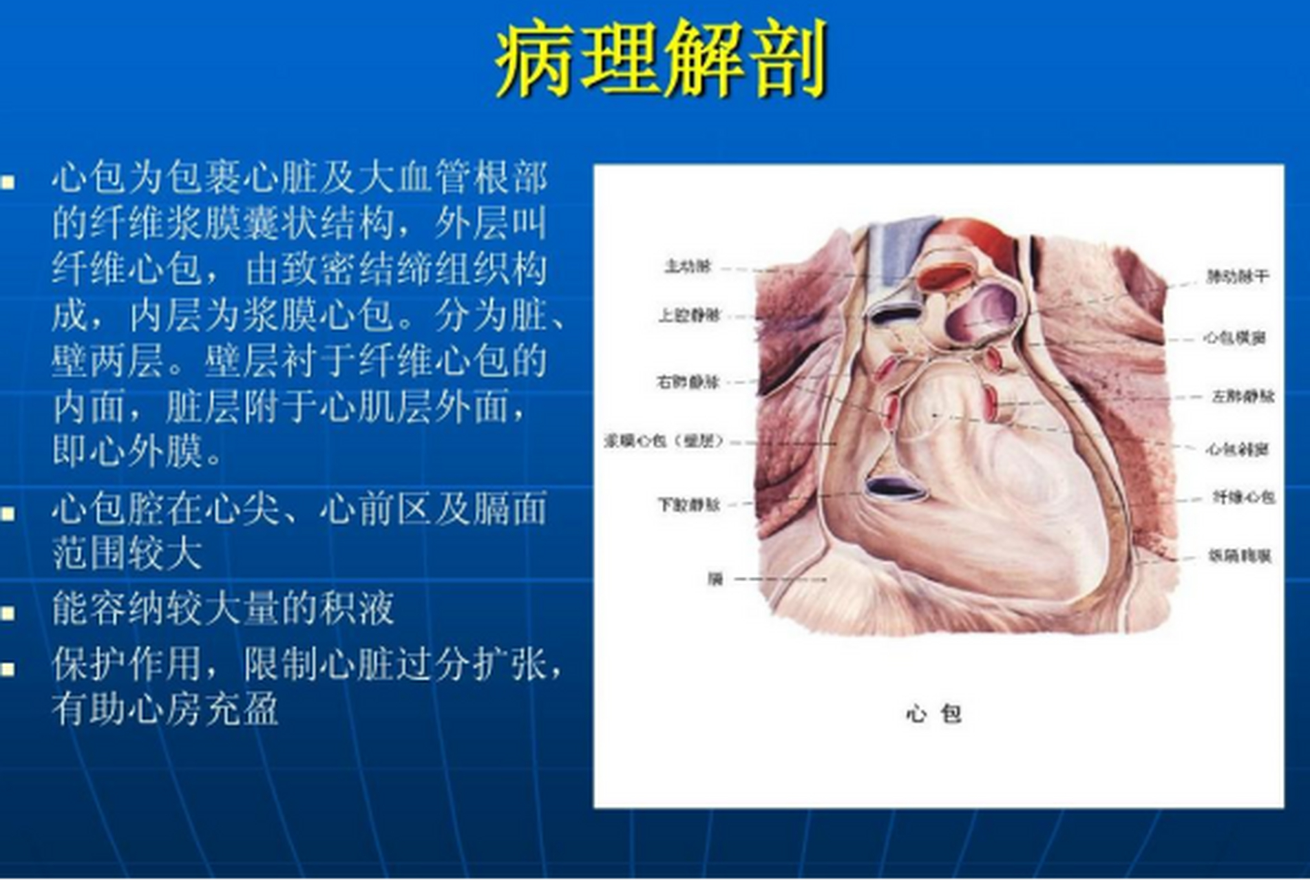 心包积液图解图片