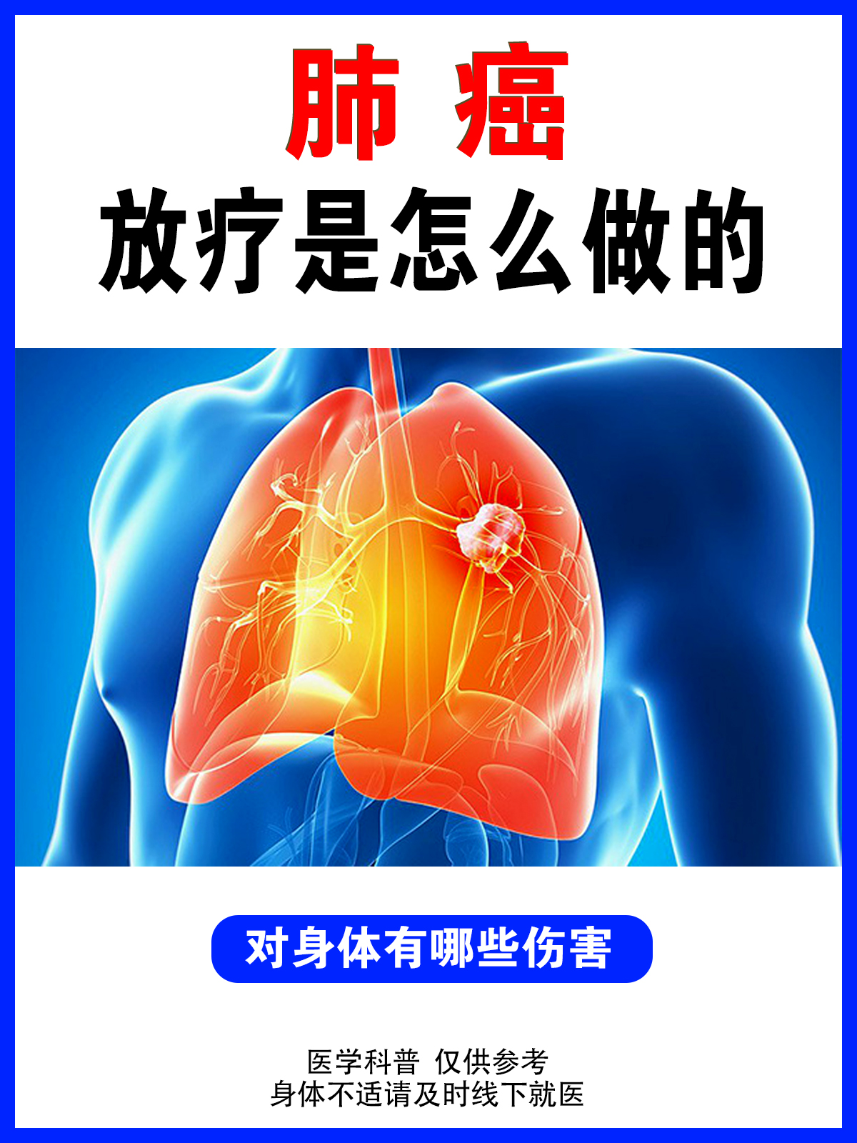 肺癌患者选择放疗放疗对身体有哪些影响呢?
