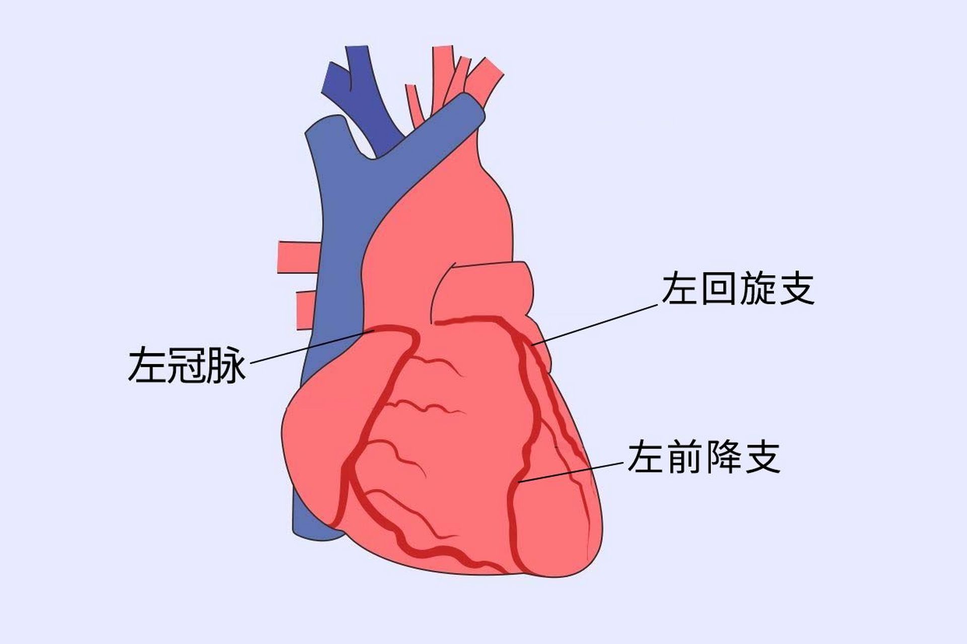 什么是冠心病图片