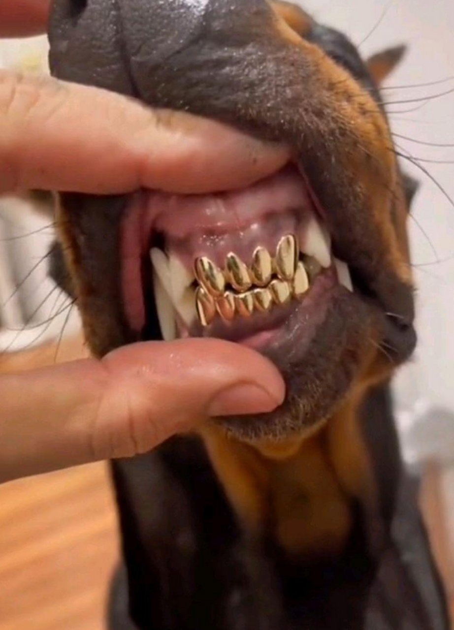 这口金牙我一个半月工资没了