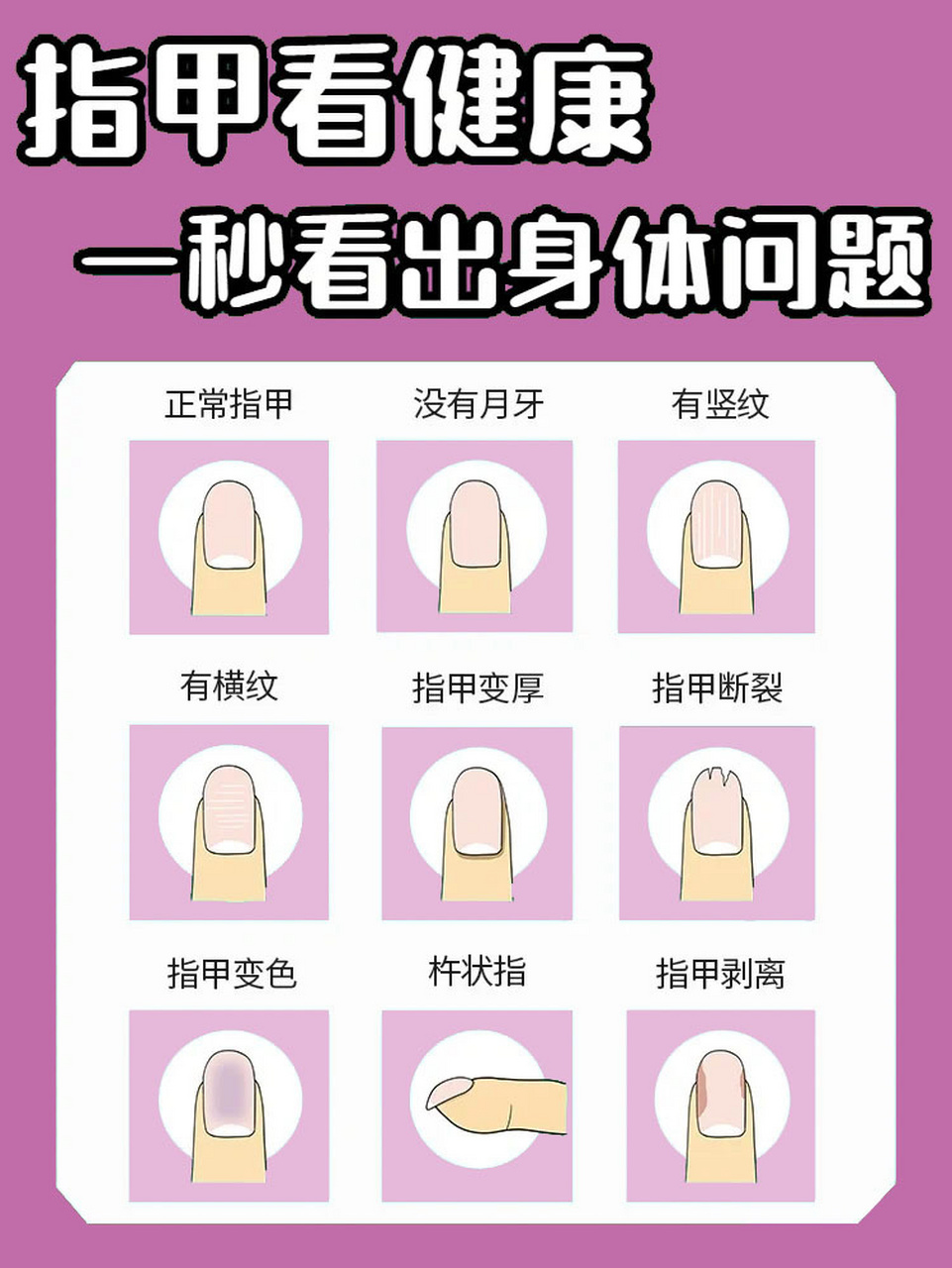 指甲看健康|多观察指甲,了解身体问题93 没想到吧,指甲也能反映人体