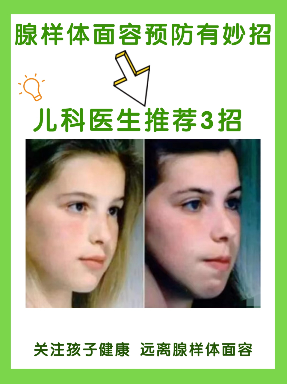 儿科主任:腺样体面容预防有妙招,这3招!