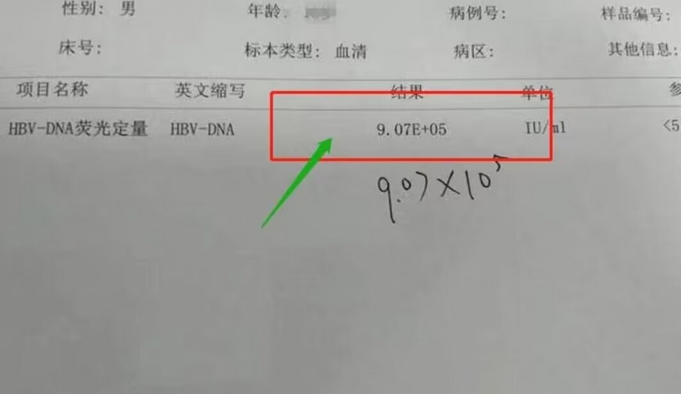 乙肝病毒的dna定量检测,是用来检测患者血清当中乙肝病毒的含量有