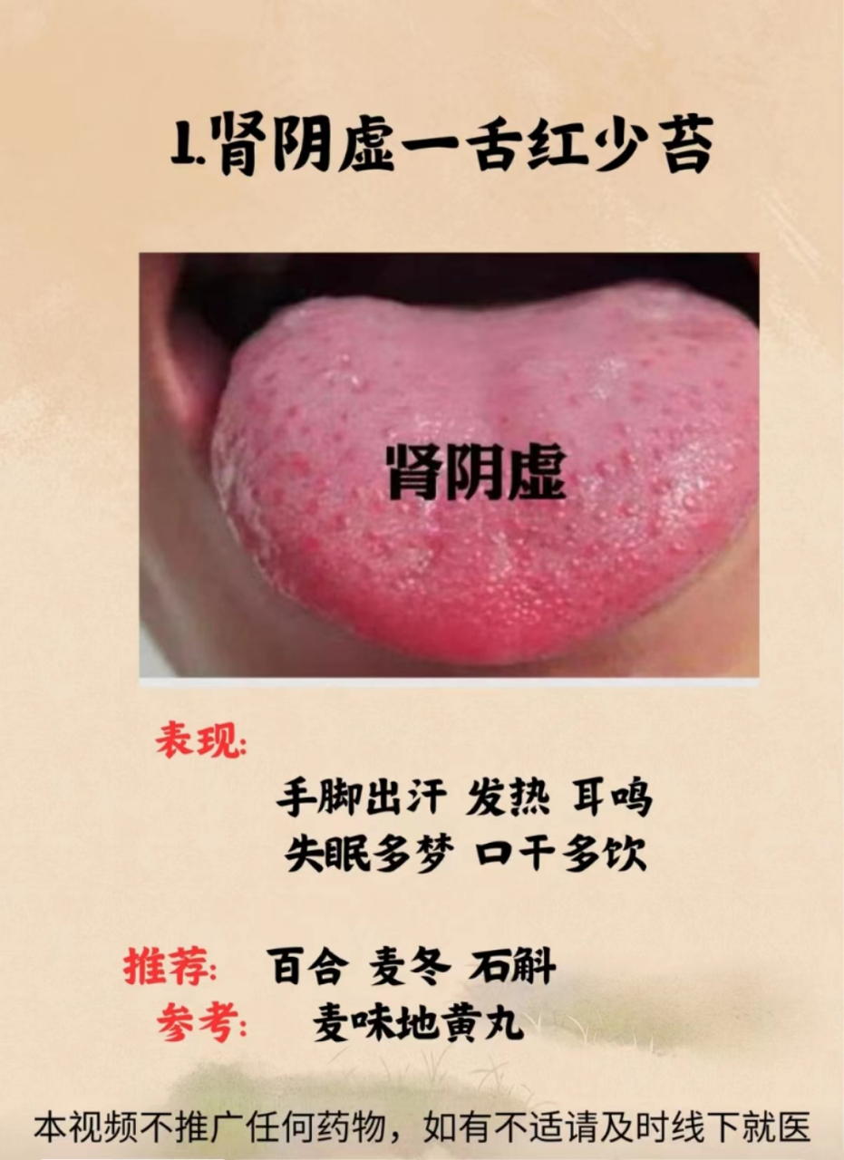 肾虚# #肾阳虚# #肾精亏虚# #肾阴阳两虚# #肝肾阴虚# #男科# #男性