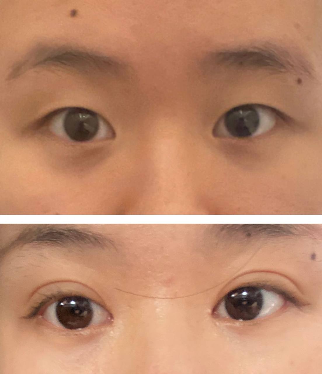 小姑娘原相机双眼皮!