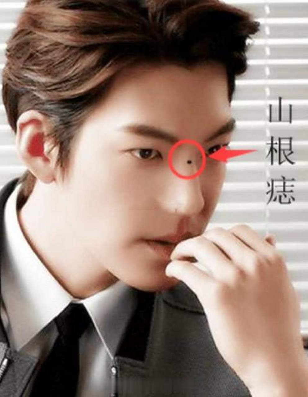 2,鼻梁痣在事业上还是有不错的成就的,但是财运难聚3,鼻头痣人生的易