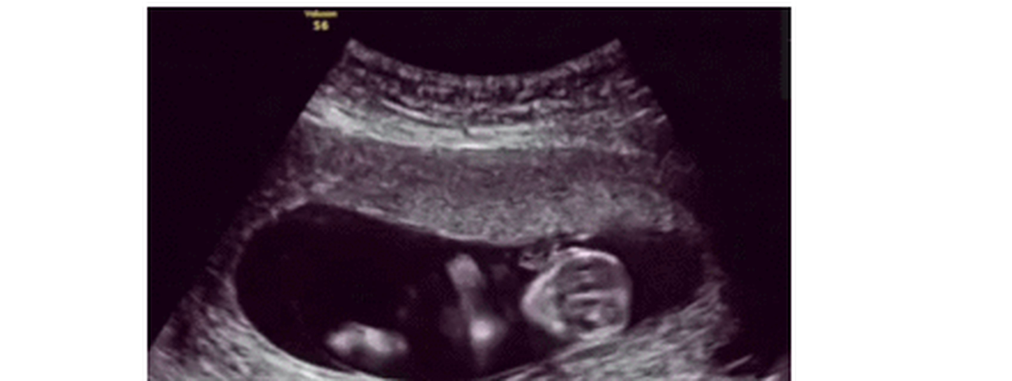 怀孕29周,胎儿大概有多大?