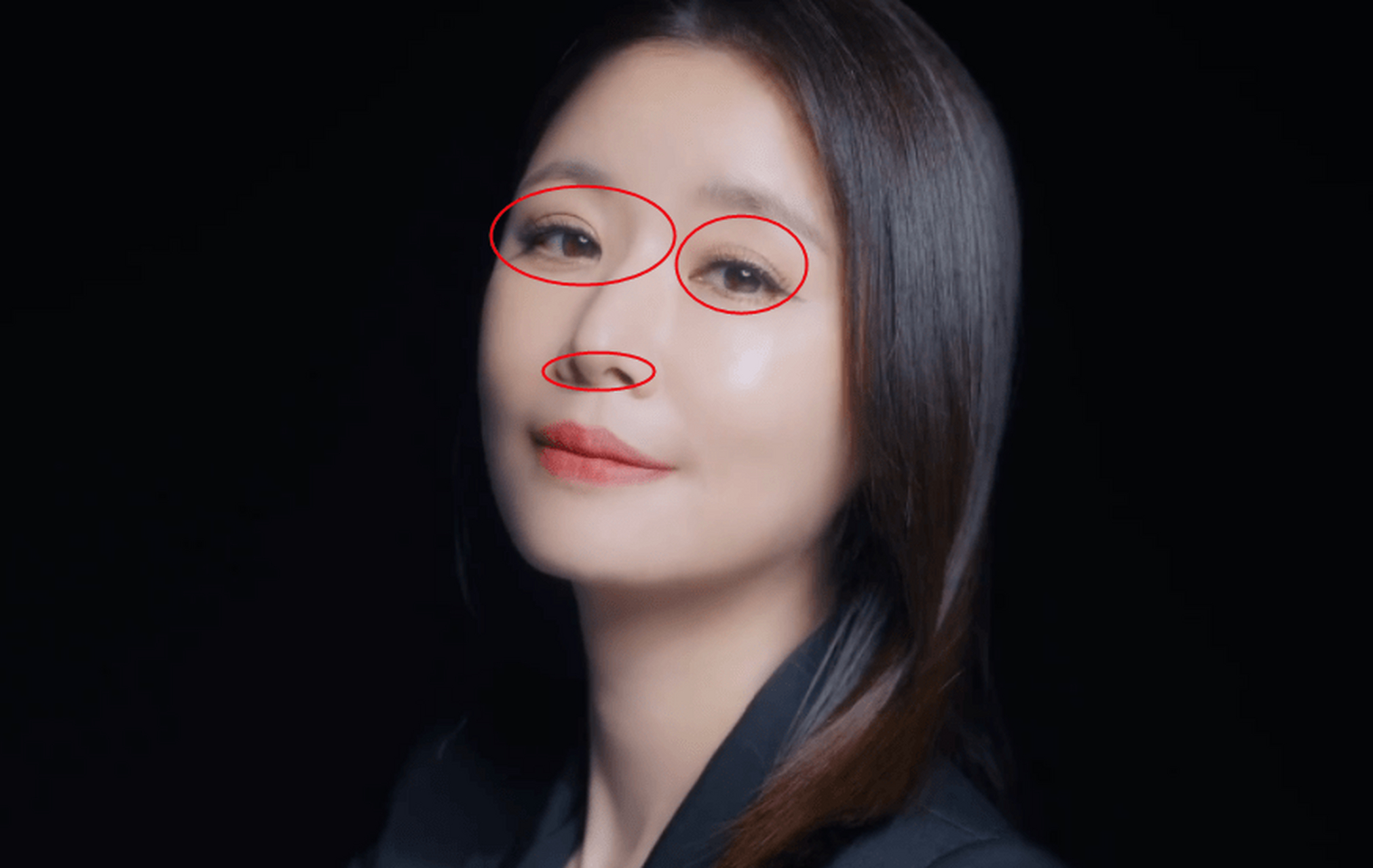 47岁林心如近照曝光,双眼皮变宽眼神黯淡,脸部僵硬被质疑整容