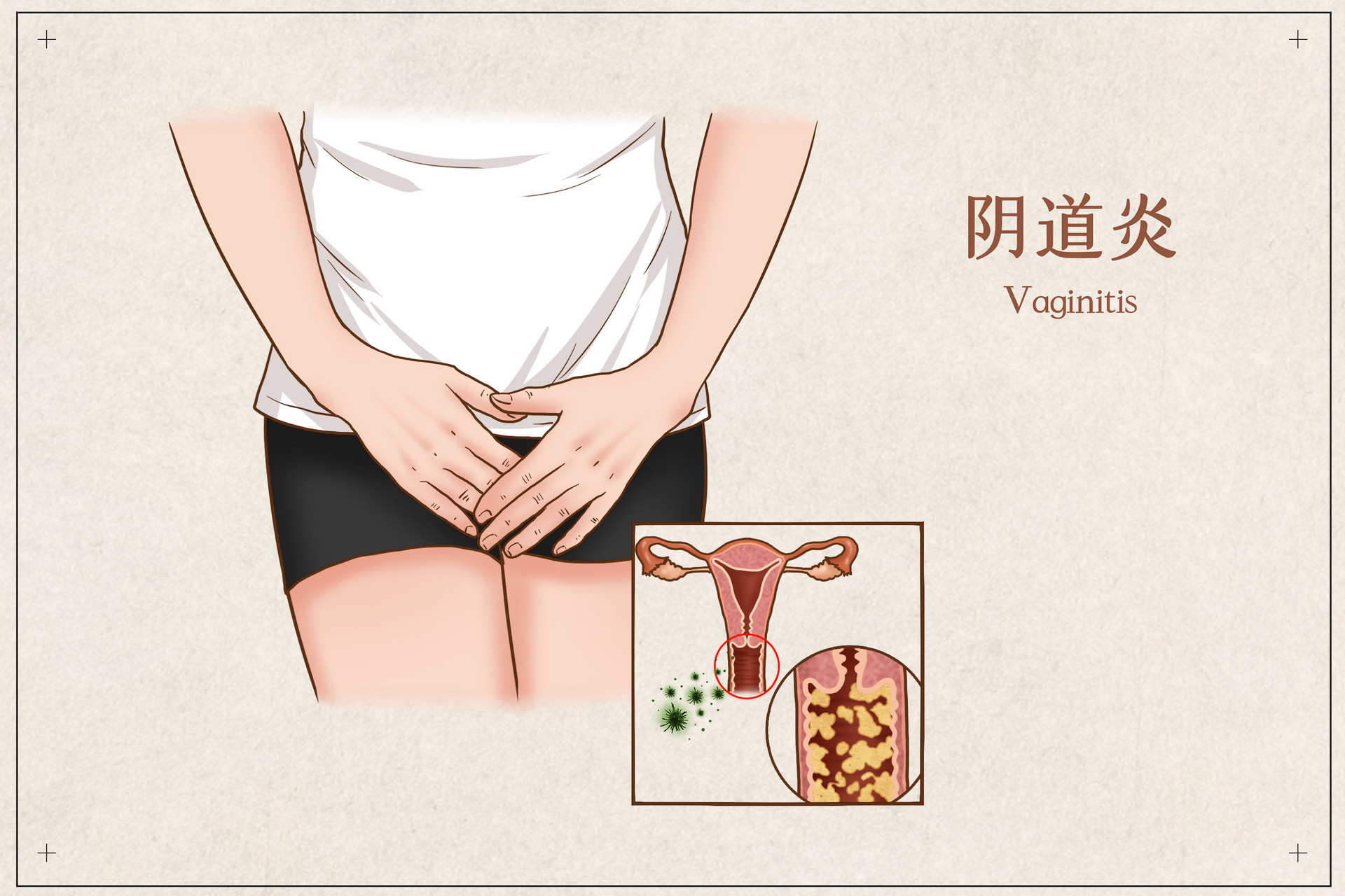 长春市那个医院妇科好,选#长春和谐妇科医院# 长春市是吉林省的省会