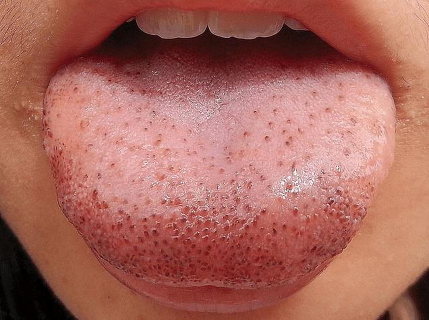 心血虚,舌头颜色可能较为淡或暗沉,舌苔薄白,舌边缘可能有细小的裂纹