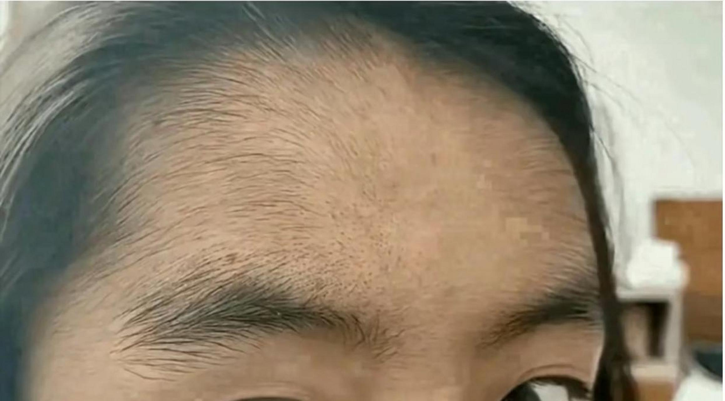 虽然发际线很低,但该秃还是得秃. #中国版chatgpt来了# #娱乐最前沿