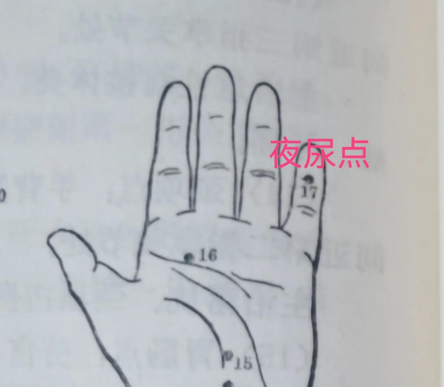 手上的夜尿点,胃肠点,咳喘点,足跟点  手上有很多穴位,根据自己身体的