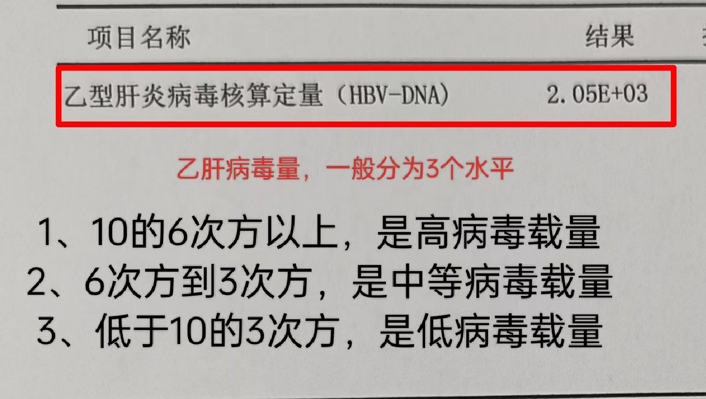 乙肝病毒dna检测,怎么看,我教你#乙肝# #科普# #涨知识