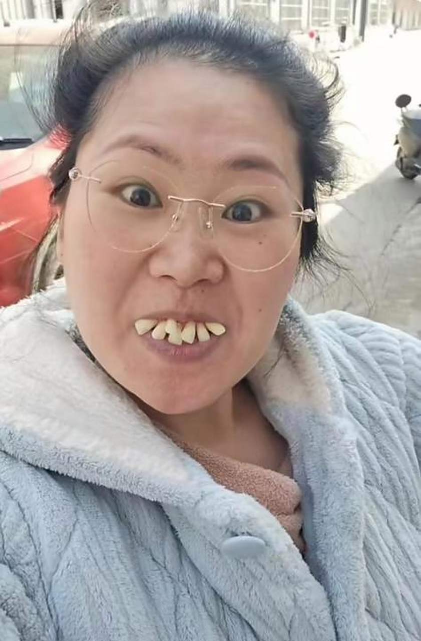 牙齿长这么歪为什么不去矫正?