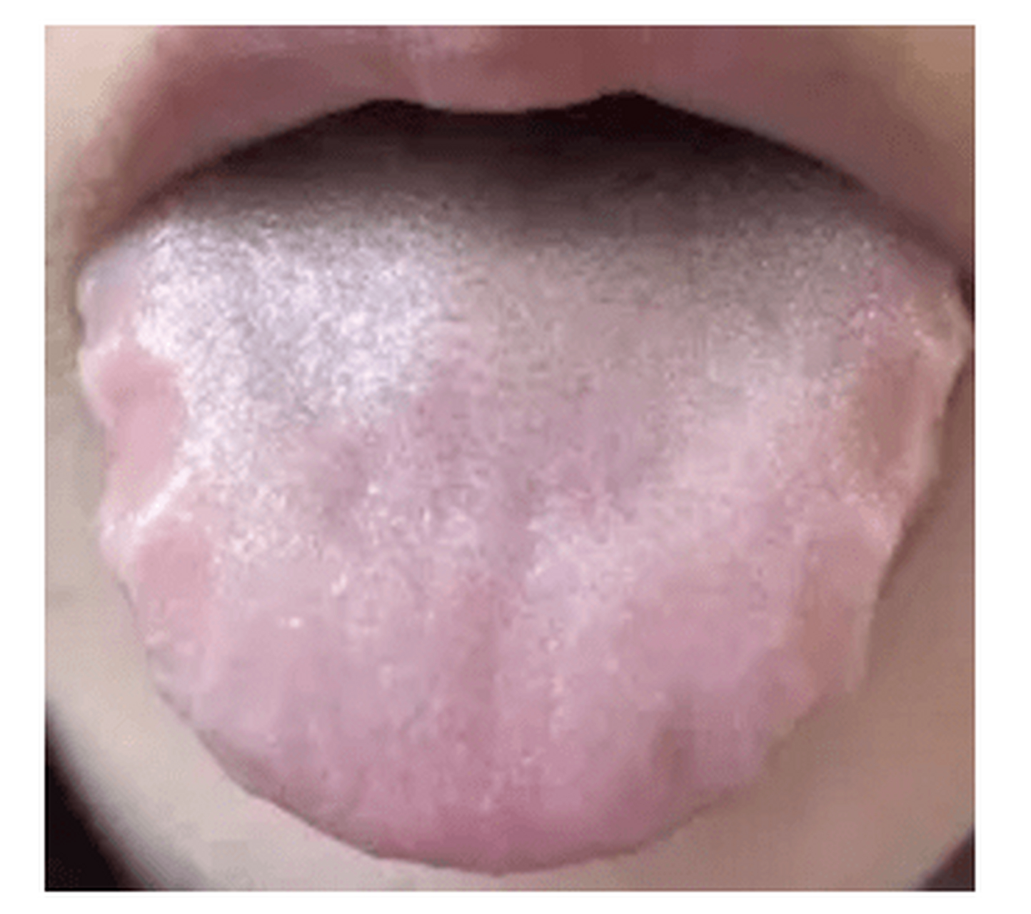 舌头有齿痕脾胃虚弱的人收好了,这个代茶饮方子,我只发一次 【组方】