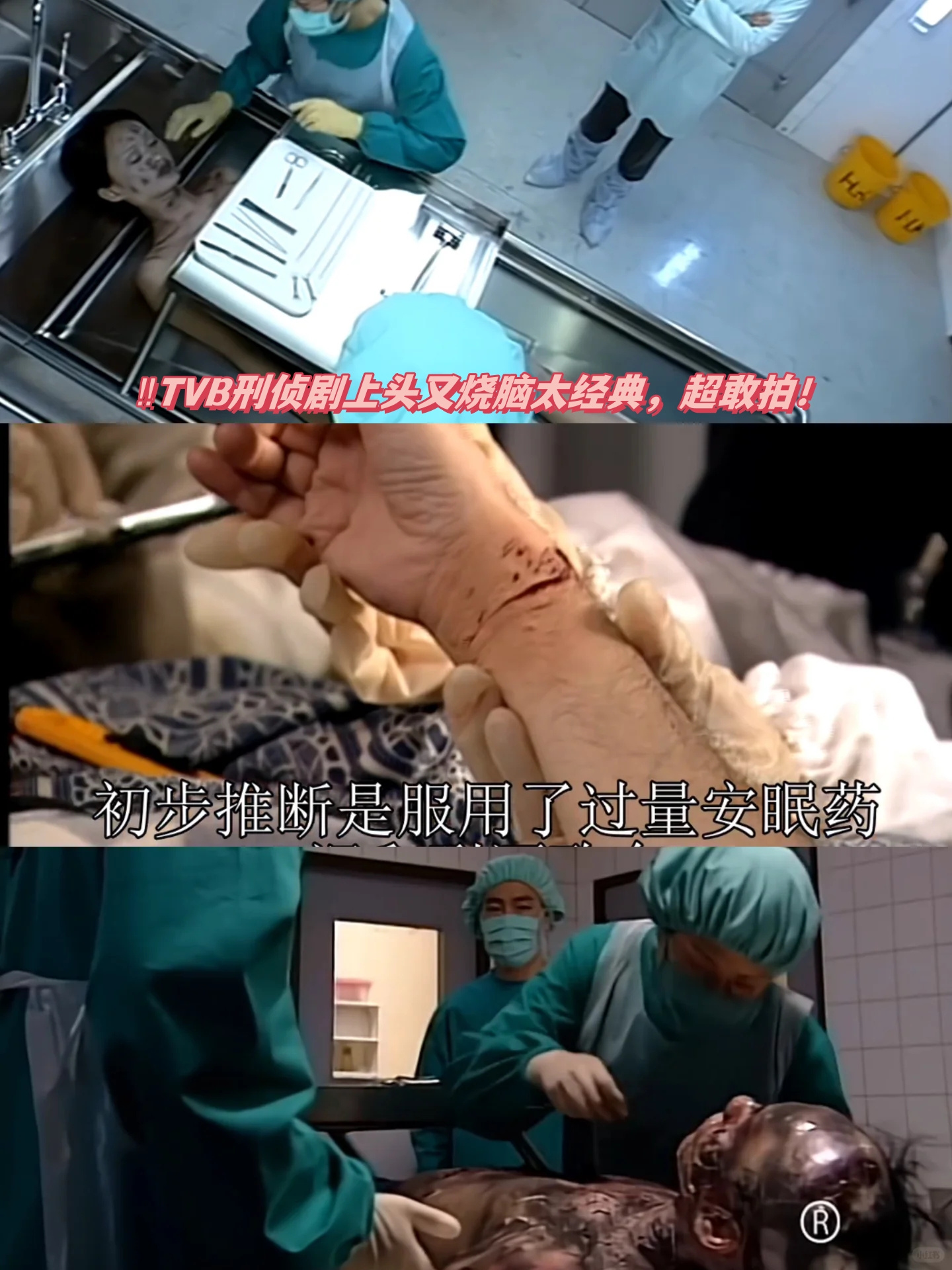 陈慧珊脚