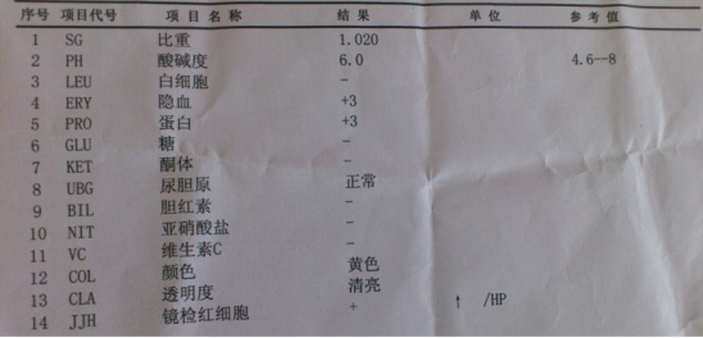 急性肾小球肾炎是肾病内科比较常见的疾病.