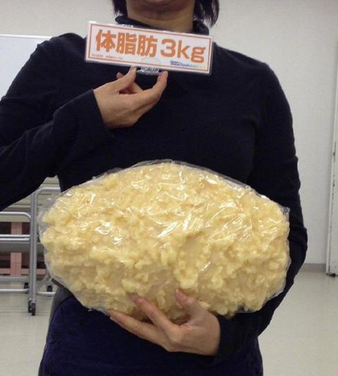 3kg脂肪的体积,感受下你胖了20斤会是什么样子 67676767