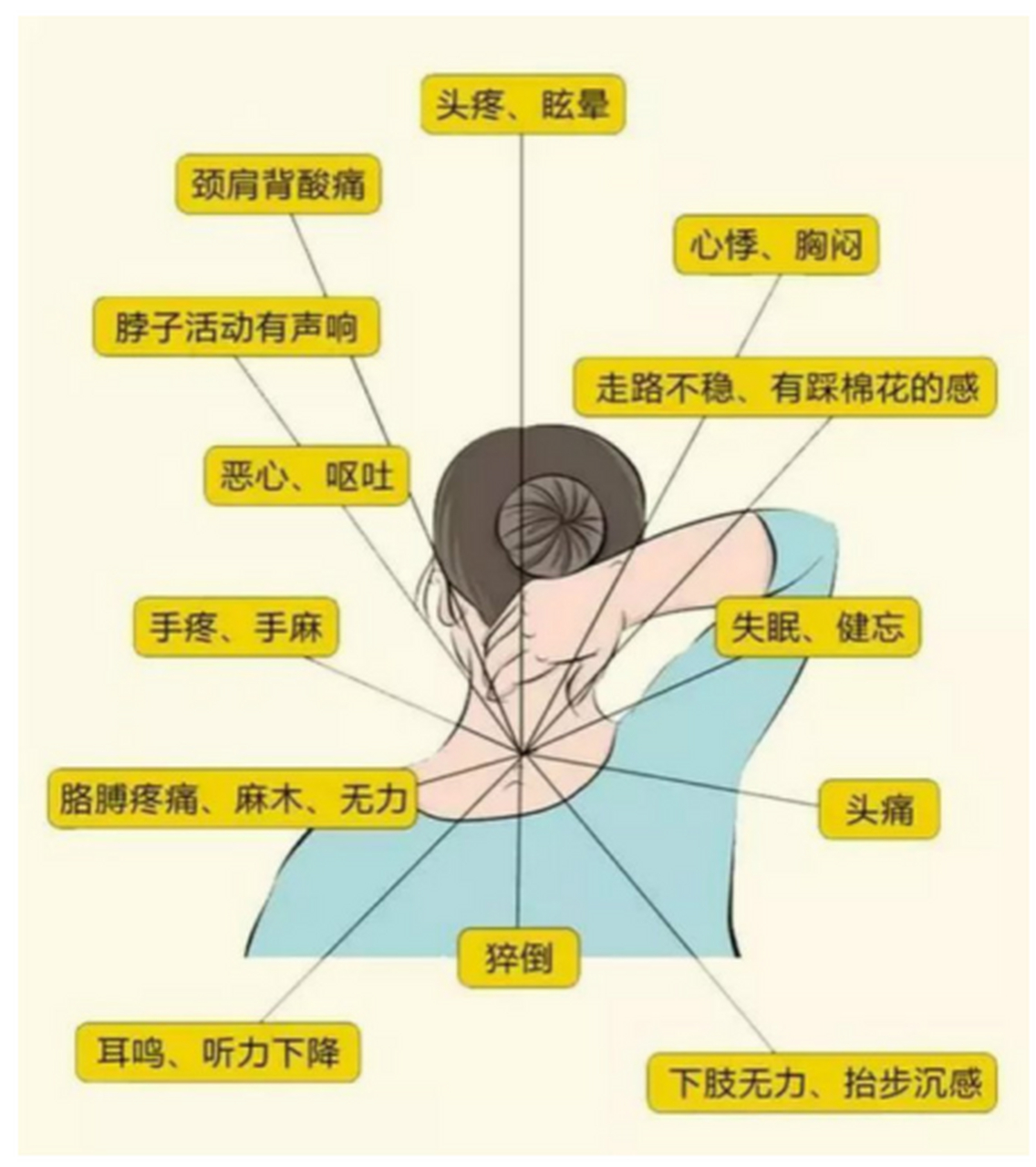 颈椎病早期有哪些症状 发现颈椎病早期有哪些症状可以提前发现自己