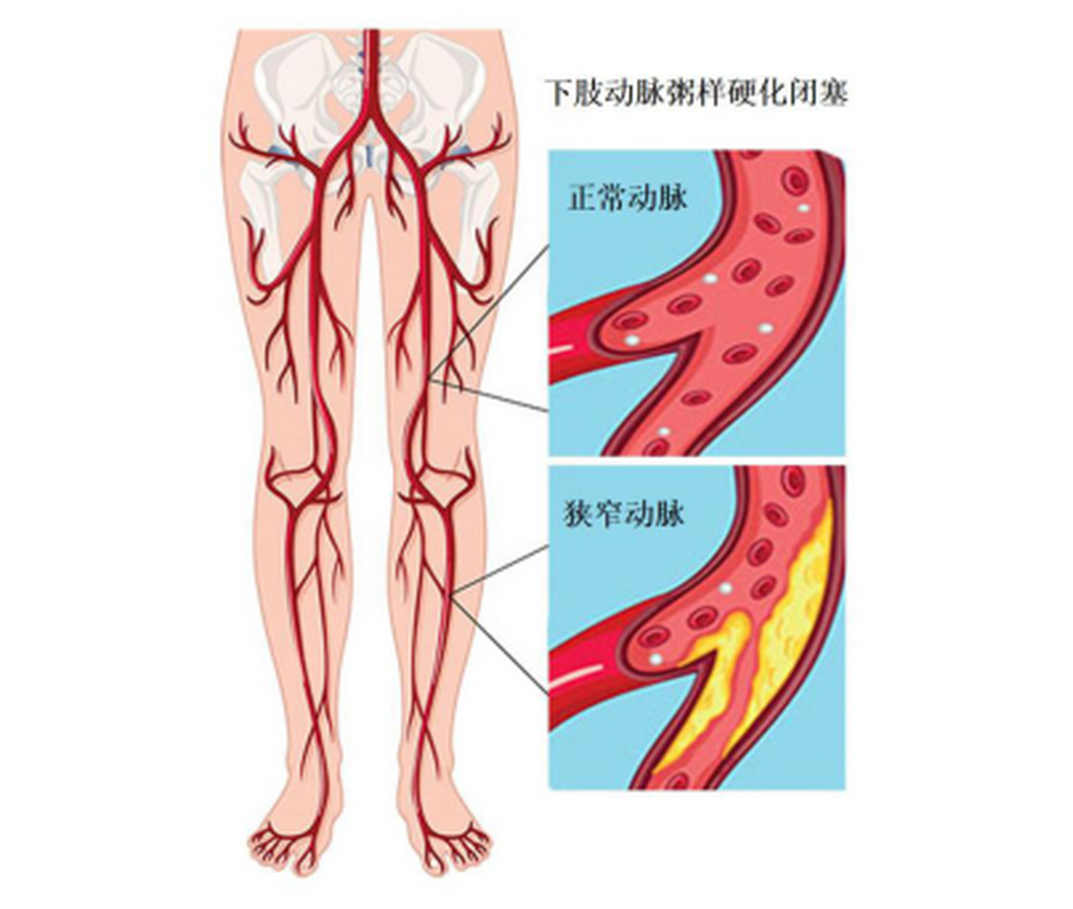 股动脉的位置图片