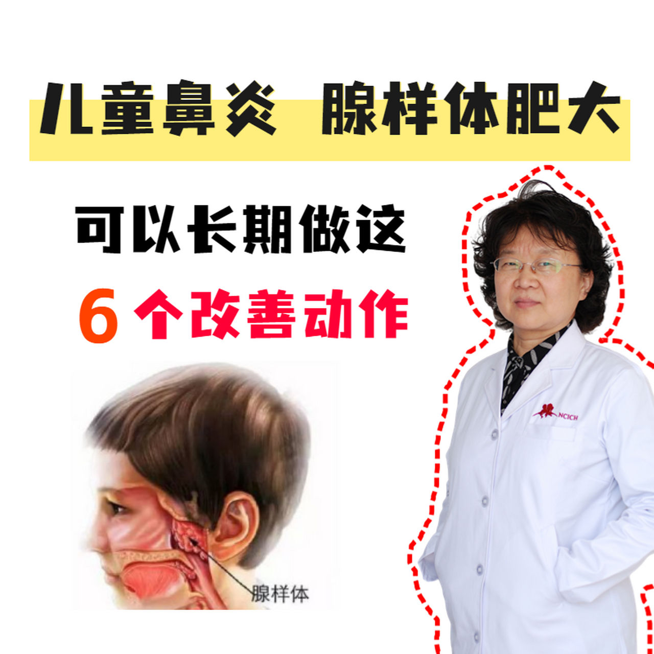 兒童腺樣體肥大,可以長期做的6個改善動作!