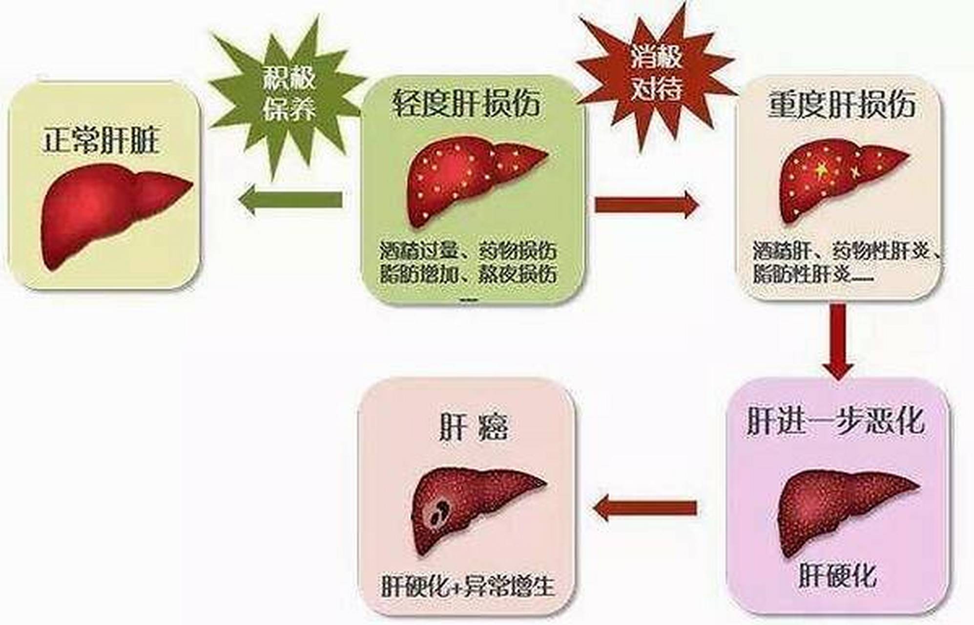 肝硬化的九大病因,快收藏!  1.